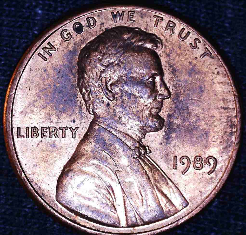 1989-P-LMC...normal-Eyelid-Or?